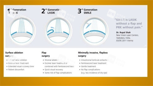 近视眼照片图 近视眼照片图