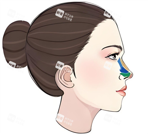 隆鼻修复图 隆鼻修复图