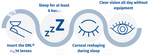 角膜塑形镜过程