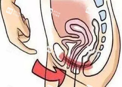 女性私密整形位置示意图 女性私密整形位置示意图