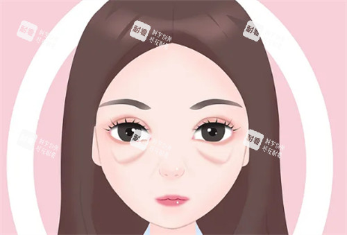 眼袋图