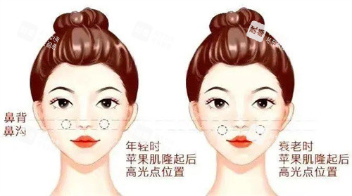 幼态脸面部平整度高