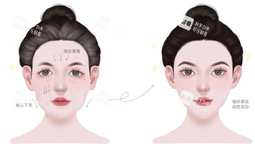 幼态脸前后紧致度对比