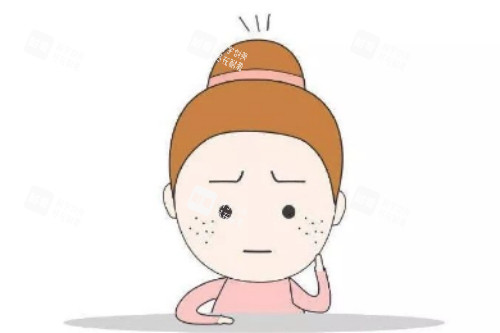 脸上长斑卡通展示图