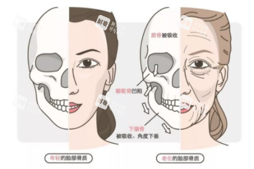 年轻、年老脸部骨骼对比图
