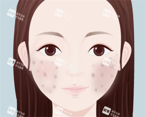 脸上痘印怎么办