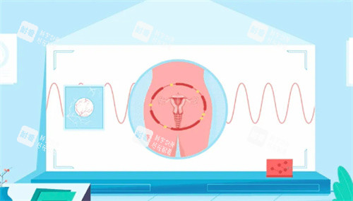 私密紧致卡通图