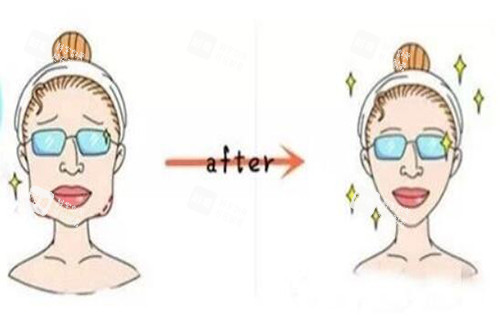 面部轮廓对比卡通