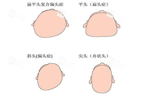 各种头型卡通图