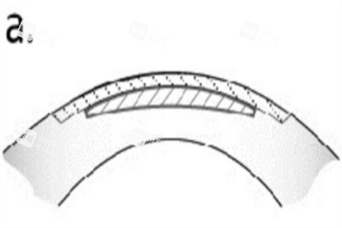 全飞秒透镜示意图 全飞秒透镜示意图