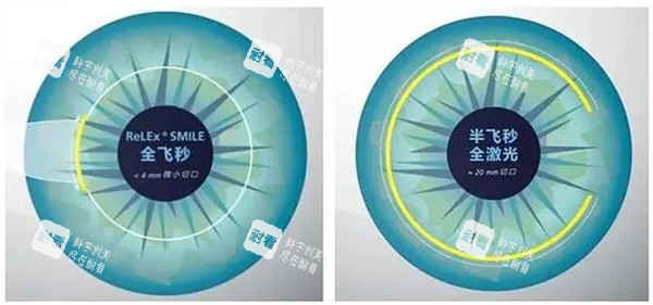 全飞秒半飞秒激光照片 全飞秒半飞秒激光照片