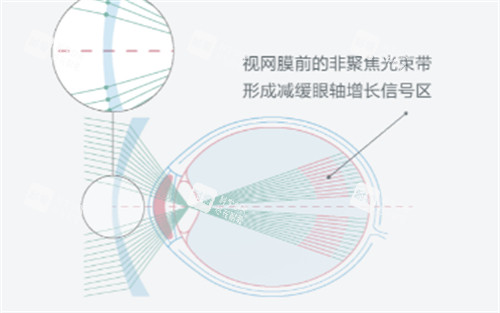 依视路星趣控镜片的作用图解