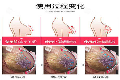 魔力贴丰胸使用变化图