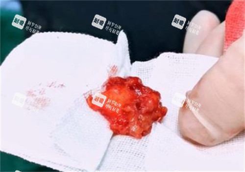 下巴取出的生长因子