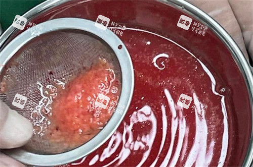 手术取出的不明注射物