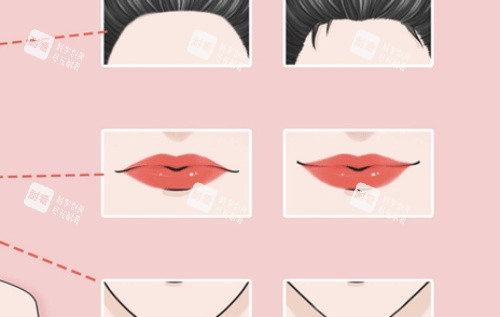 丰唇注射对比图