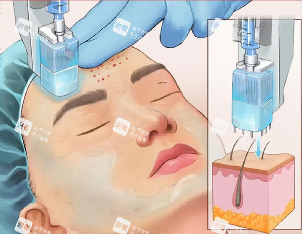 广州丽人医疗美容靠谱吗?进口仪器加持,眼部整形等项目口碑佳