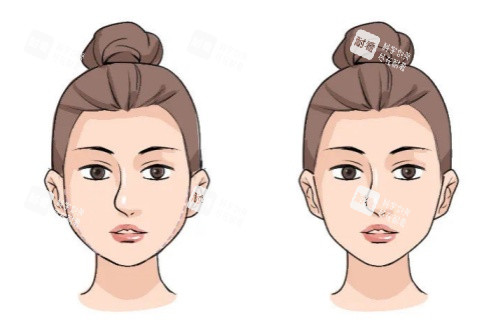 面部馒化修复卡通对比图