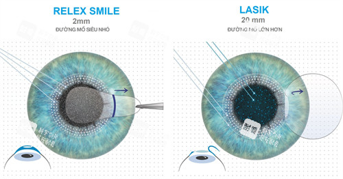 全飞秒跟半飞秒对比