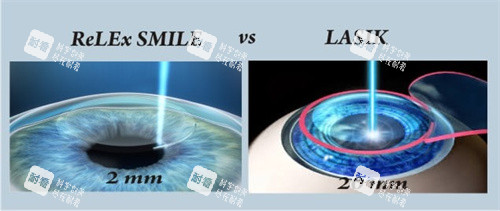 全飞秒和半飞秒图示