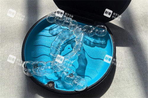 隐适美牙齿矫正