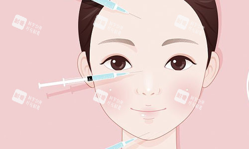 注射美容的部位示意图