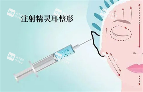 精灵耳注射动画图