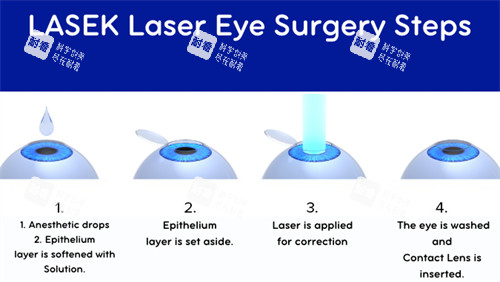 近视手术流程图