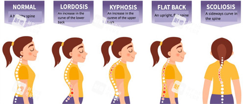 富贵包对体态的影响