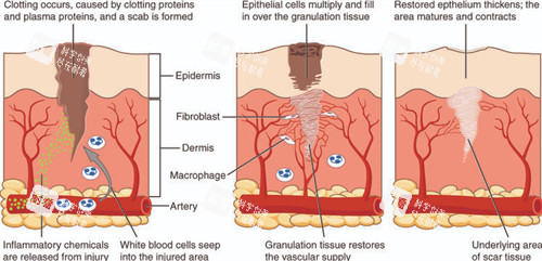 改善皮肤色素疤痕 改善皮肤色素疤痕