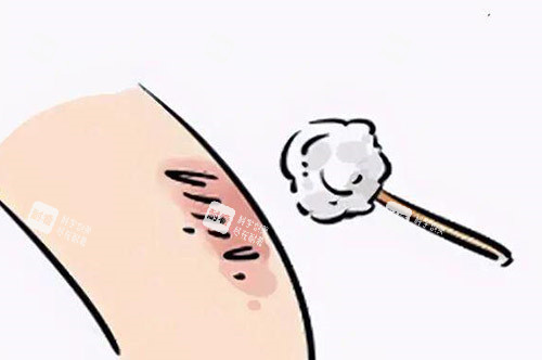 疤痕改善祛除卡通图