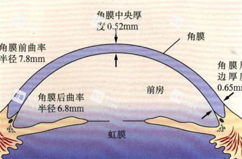 圆锥角膜数据分析图解