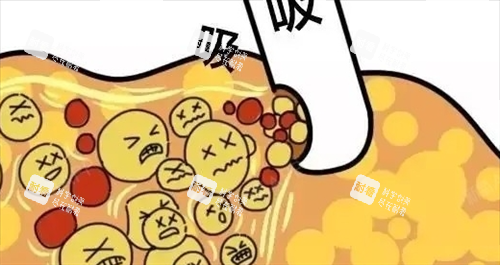 吸脂过程动画展示图