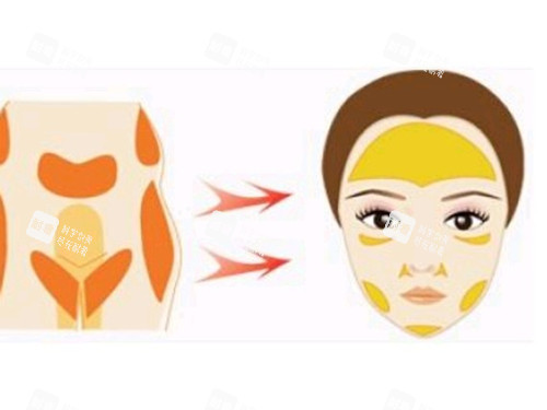 脸部脂肪填充图片 脸部脂肪填充图片