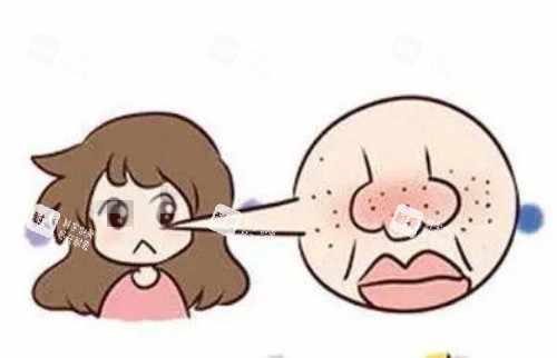 鼻子部位毛孔粗大示意图