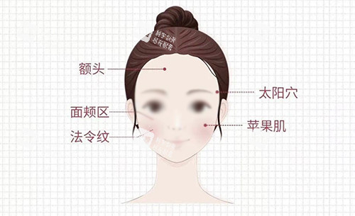 面部注射区 面部注射区