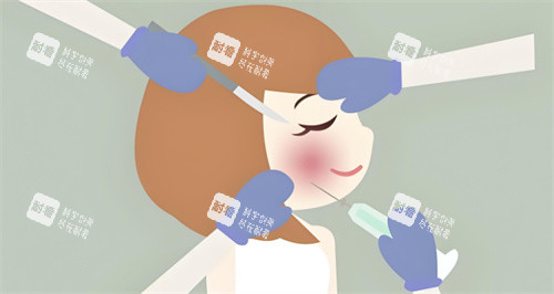 玻尿酸注射图 玻尿酸注射图