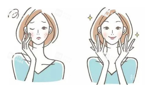 毛孔粗大医美前后对比图 毛孔粗大医美前后对比图