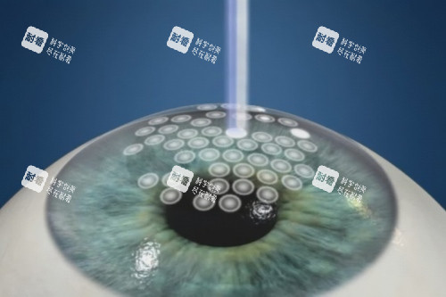 smart全激光 smart全激光