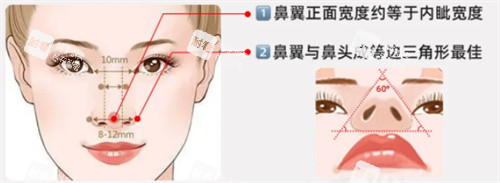 鼻翼缩小鼻翼图