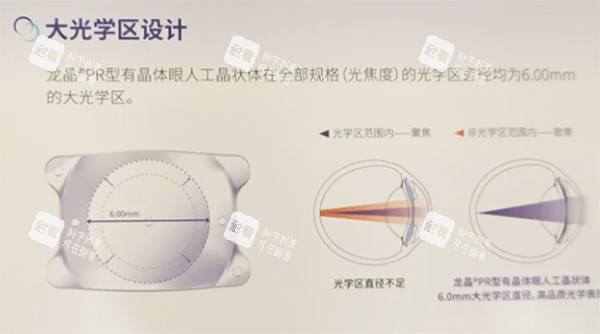 龙晶人工晶体大光学区设计 龙晶人工晶体大光学区设计