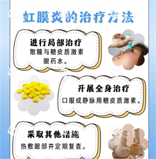 虹膜炎的治疗方法细节图 虹膜炎的治疗方法细节图