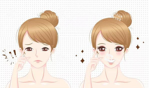 双眼皮术宣传图 双眼皮术宣传图