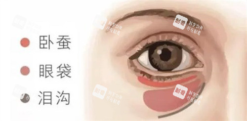 卧蚕眼袋泪沟的区别
