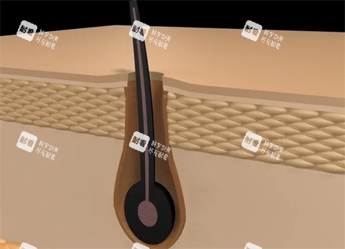 毛囊放大照片 毛囊放大照片