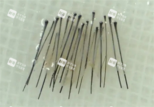 毛囊处理照片 毛囊处理照片