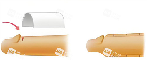 男性增粗手术示意图 男性增粗手术示意图