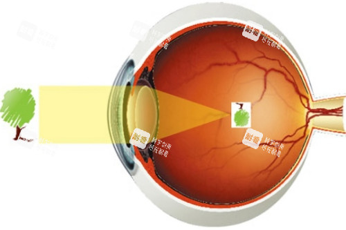 近视视物图 近视视物图