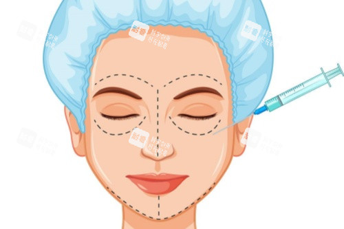 面部注射卡通图片展示 面部注射卡通图片展示