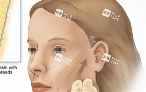 微拉美提升方向动画展示